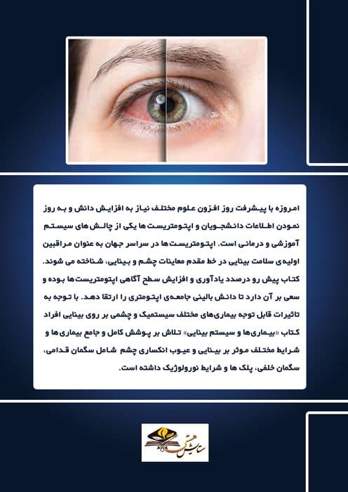 بیماری ها و سیستم بینایی
