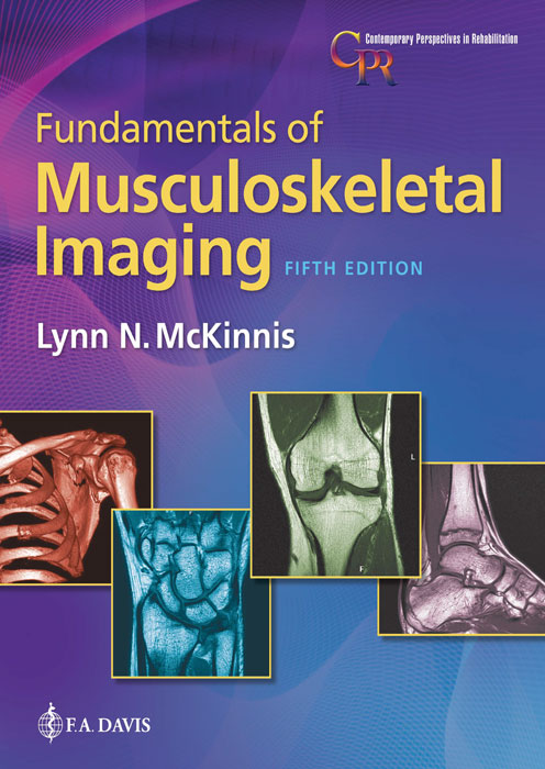 Fundamentals of Musculoskeletal Imaging E-book