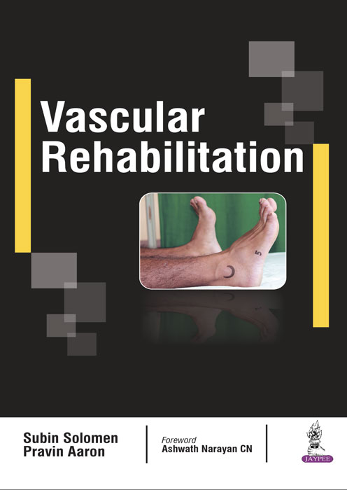 Vascular Rehabilitation