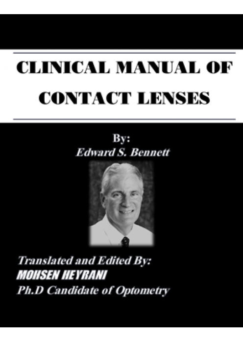 راهنمای کلینیکی لنزهای تماسی