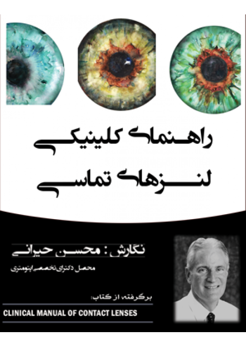 راهنمای کلینیکی لنزهای تماسی