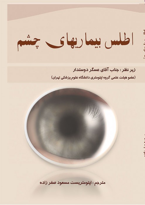 اطلس بیماریهای چشم