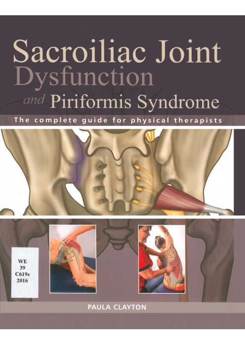 Sacroiliac Joint Dysfunction and Piriformis Syndrome 