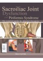 Sacroiliac Joint Dysfunction and Piriformis Syndrome 